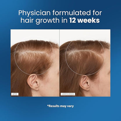Be Bodywise Advanced Rosemary Hair Growth Roll-On Serum | Clinically Proven Hair Regrowth Treatment